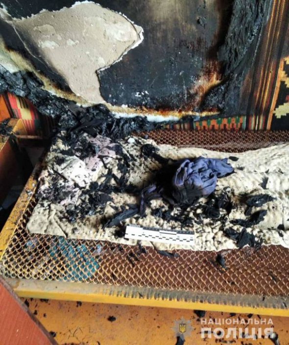 У чоловіка 70% опіків тіла