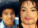 Майкл Джексон до и после пластических операций.