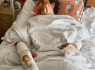 Лидия Макарчук получила осколочные ранения, которые изуродовали ее тело