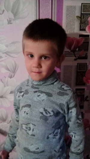 5-летний Владислав Чеснок из села Бабенковка-2 Каланчатского района Херсонской области имеет врожденную частичную щель неба срединную. На лечение и операцию требуется не менее 30 тыс. грн.