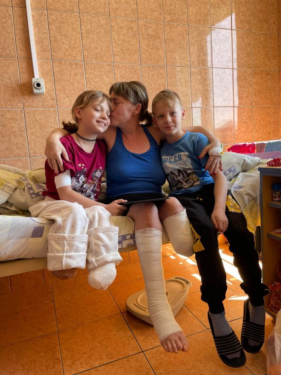 Жінка Наталя та її донька Яна постраждали внаслідок ракетного обстрілу Краматорська