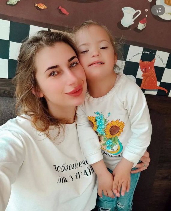 У Вінниці рятують Ірину Дмитрієву, яка з трирічною донькою потрапила під ракетний обстріл