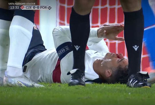 Кріштіану Роналду розбили ніс у матчі Ліги націй Чехія – Португалія