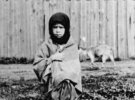 Дівчинка з опухлими з голоду колінами у Харкові влітку 1933 року. 