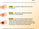 Міністерство охорони здоров'я опублікувало інструкцію, що робити у разі термічних опіків.