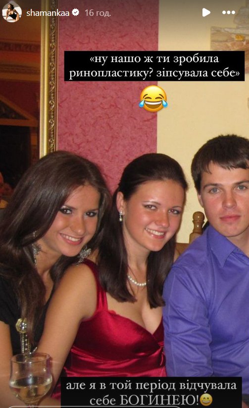 Аліна Шаманська показала себе до пластики