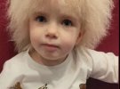 3-річна Лейла Девіс живе з рідкісним синдромом "нерозчесаного волосся". Через цю особливість дівчинку порівнюють з Борисом Джонсоном, а друзі називають "Пухнастиком"