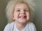 3-летняя Лейла Дэвис живет с редким синдромом "нерасчесанных волос". Из-за этой особенности девочку сравнивают с Борисом Джонсоном, а друзья называют "Пушистиком"
