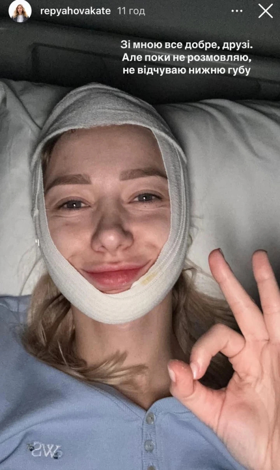 Екатерина Репьяхова вставила имплант в подбородок