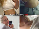 Инна Белень сделала подтяжку груди