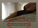 Инна Белень сделала подтяжку груди