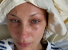 Белла Хадид попала в больницу из-за обострения болезни Лайма, поделилась эмоциональными фото из палаты и получила волну поддержки от поклонников