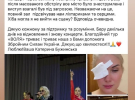 Катерина Бужинська виступала з травмованим оком, попри рекомендації лікарів