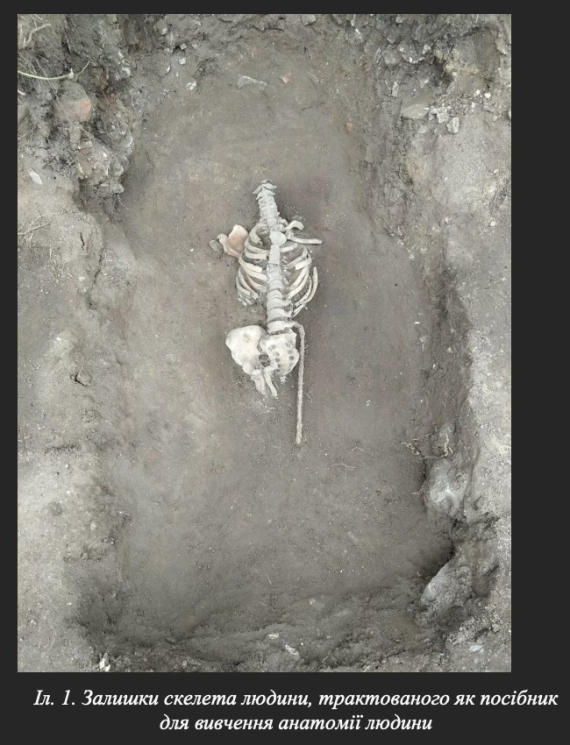 У підземеллях колишнього домініканського комплексу знайшли сліди стародавньої медицини