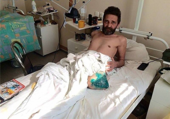 "Мюнхаузен"-Сафонов на лікарняному ліжку з ампутованою ногою