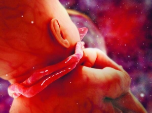 До 34 тижнів вагітності гінекологи не звертають увагу на обвиття пуповиною. Дитина ще може розплутатися