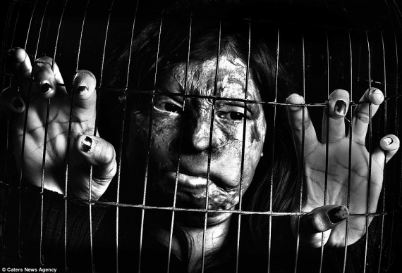 Індійські жінки з понівеченим обличчям показали біль та страждання у фотопроекті