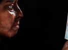 Индийские женщины с изуродованным лицом показали боль и страдания в фотопроекте