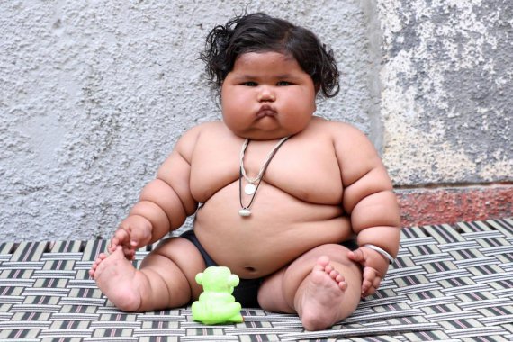 Восьмимісячна Чахат Кумар з Індії важить 20 кілограмів