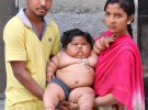 Восьмимесячная Чахат Кумар из Индии весит 20 килограм