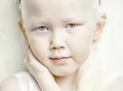 8-летнюю Нарию из Якутии называют "сибирской Белоснежкой"