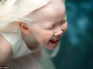 8-летнюю Нарию из Якутии называют "сибирской Белоснежкой"