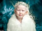 8-летнюю Нарию из Якутии называют "сибирской Белоснежкой"