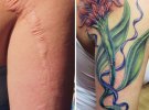 Татуировки на шрамах стали трендом сети
