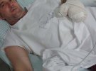 Карлос Маріотт отримав травму, коли його рука потрапила між коліщатками верстату