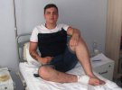 Обломки мины тяжело истерзали ногу и руку Игоря.