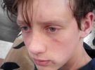 16-летнего инвалда побил надзиратель колонии за фото в старом "Запорожце"