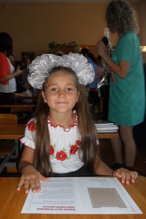 9-річна Анна Куценко 1 червня постраждала від вогню