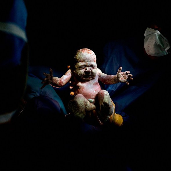 Новорожденные в первые 20 секунд жизни