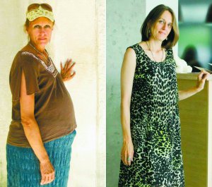 Тетяна Скоробагата до операції важила 85 кілограмів (фото ліворуч), а після видалення пухлини — 54