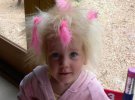 Унікальна дитина: у дівчинки росте волосся, яке неможливо розчесати
