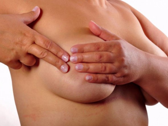 Уплотнения в тканях молочной железы не является точным сигналом рака груди