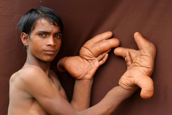 Тарик с Индии с гигантскими руками