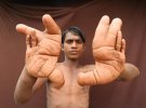 Тарік з Індії з гігантськими руками