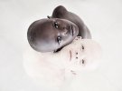 Фотопроект на захист дітей-альбіносів у Танзанії
