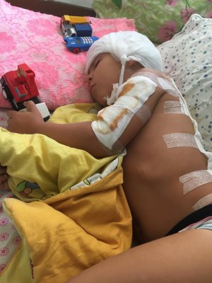 Данило Чепинога із Запоріжжя лежить в обласній дитячій лікарні. Після аварії хлопчику зашили голову, обробили рани на тілі