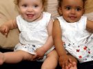 Марсия и Милли: близняшки с разным цветом кожи