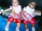 Марсія та Міллі: близнючки з різним кольором шкіри