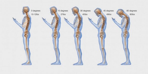 Если голову слишком наклонять к смартфону, нагрузка на шею может достигать 27 кг