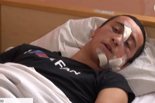 Оперуполномоченный Самарского РО полиции Днепра Гамид Росулзаде, раненый при взрыве, говорит, что у них под ногами взорвалась граната