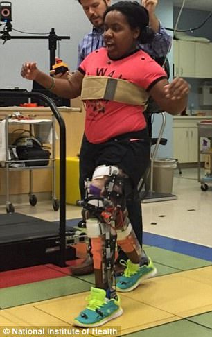 Робототехнічний екзоскелет допомагає ходити дітям із церебральним паралічем