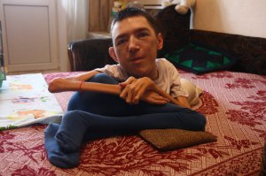 Антон Дубішин лежить на дивані у своїй квартирі в Києві. Його доглядає мати. Тіло майже не рухається