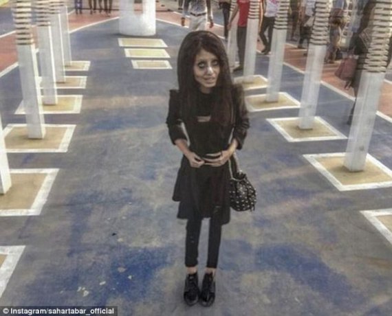Иранка сделала 50 операций ради сходства с Анджелиной Джоли и теперь похожа на зомби
