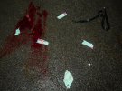 Чоловік підірвав гранату біля ніг відвідувача залу ігрових автоматів у Дніпрі