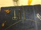 Пересадка крила: жінка зробила метелику трансплантацію 
