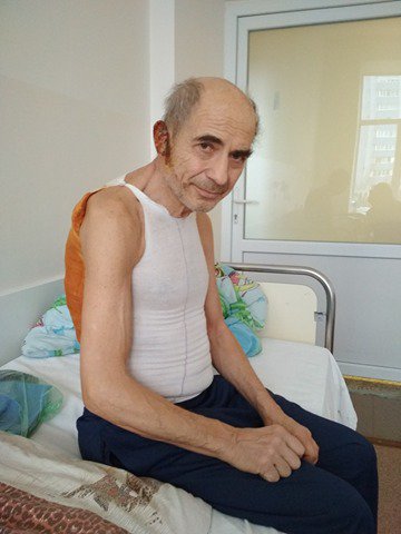 66-річний Станіслав Артеменко з Києва лікує гострий мієлобласний лейкоз